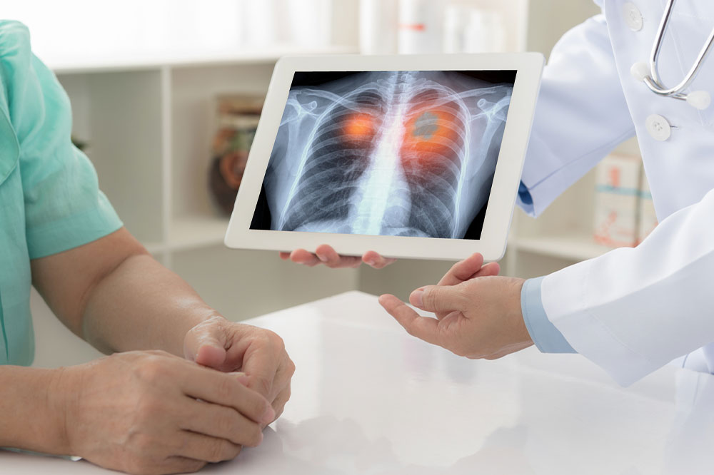 6 signs that indicate a lung disease